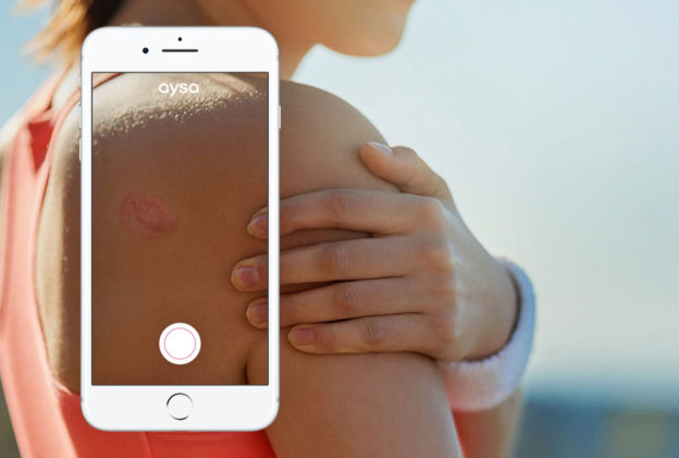 Skin Rash App: Answers When You Need Them » Ask Aysa
